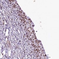Anti-SAMD10 antibody produced in rabbit 
