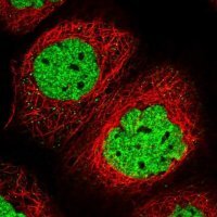 Anti-SAMD10 antibody produced in rabbit 