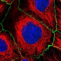 Anti-SAMD4A antibody produced in rabbit 