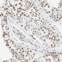 Anti-SAP18 antibody produced in rabbit 