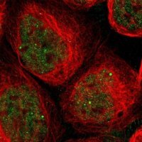 Anti-SAP18 antibody produced in rabbit 