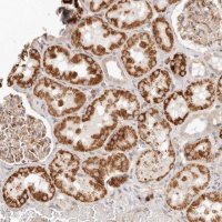 Anti-SASS6 antibody produced in rabbit 
