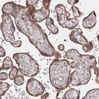 Anti-SAT1 antibody produced in rabbit 