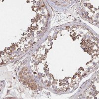 Anti-SAT1 antibody produced in rabbit 