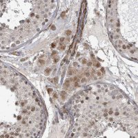Anti-SBF2 antibody produced in rabbit 