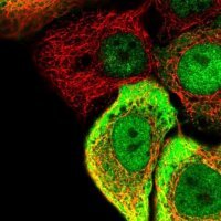 Anti-SC5D antibody produced in rabbit 