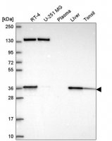 Anti-SC5D antibody produced in rabbit 