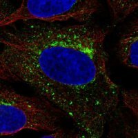 Anti-SCAMP3 antibody produced in rabbit 