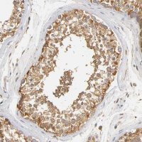 Anti-SCAP antibody produced in rabbit 
