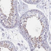 Anti-SCCPDH antibody produced in rabbit HPA050775-100UL