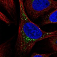 Anti-SCCPDH antibody produced in rabbit HPA050775-100UL