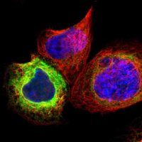 Anti-SCD antibody produced in rabbit