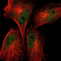 Anti-SCFD1 antibody produced in rabbit HPA003579-100UL