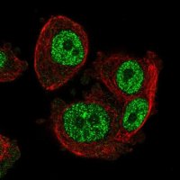 Anti-SCML1 antibody produced in rabbit