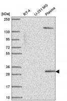 Anti-SCML1 antibody produced in rabbit