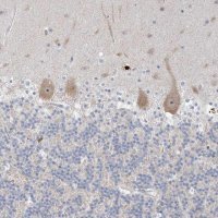 Anti-SDAD1 antibody produced in rabbit 