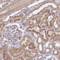 Anti-SDHD antibody produced in rabbit 