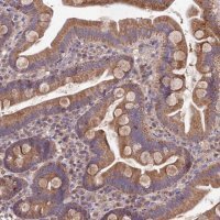 Anti-SDHD antibody produced in rabbit 