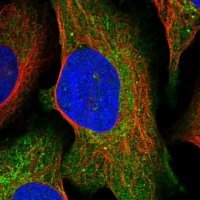 Anti-SDS antibody produced in rabbit 