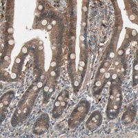 Anti-SDSL antibody produced in rabbit 