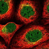 Anti-SEC24B antibody produced in rabbit
