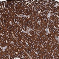 Anti-SECISBP2L antibody produced in rabbit 