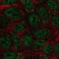 Anti-SEMA4A antibody produced in rabbit 