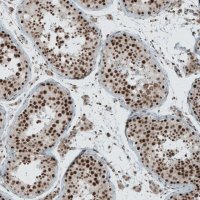 Anti-SENP1 antibody produced in rabbit 