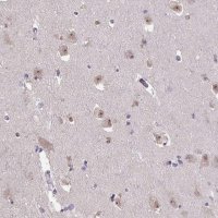 Anti-SENP3 antibody produced in rabbit 