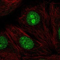 Anti-SENP3 antibody produced in rabbit 