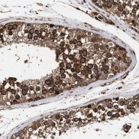 Anti-SERBP1 antibody produced in rabbit