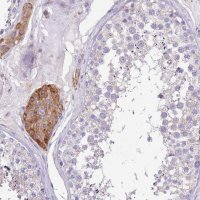 Anti-SERINC3 antibody produced in rabbit 