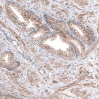 Anti-SERINC5 antibody produced in rabbit 