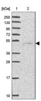 Anti-SERPINA10 antibody produced in rabbit 