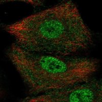 Anti-SERPINB9 antibody produced in rabbit 