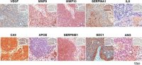 Anti-SERPINE1 antibody produced in rabbit 