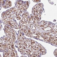 Anti-SERPINE1 antibody produced in rabbit 