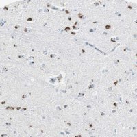 Anti-SERPINF1 antibody produced in rabbit 