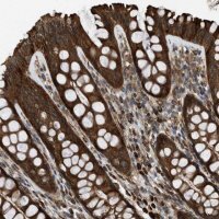 Anti-SESN2 antibody produced in rabbit