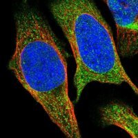 Anti-SESN2 antibody produced in rabbit