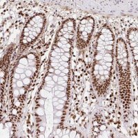 Anti-SET antibody produced in rabbit 