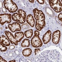 Anti-SETBP1 antibody produced in rabbit 