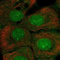 Anti-SETBP1 antibody produced in rabbit 