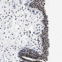Anti-SETD1B antibody produced in rabbit 