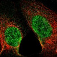 Anti-SETD1B antibody produced in rabbit 