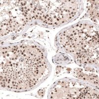 Anti-SETD2 antibody produced in rabbit 