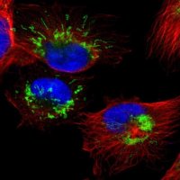 Anti-SETD3 antibody produced in rabbit 
