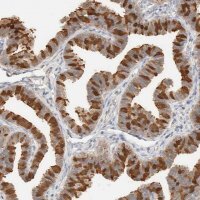 Anti-SETD4 antibody produced in rabbit