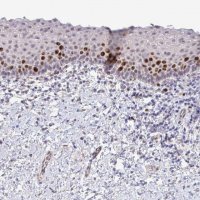 Anti-SETD7 antibody produced in rabbit 