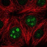 Anti-SETD7 antibody produced in rabbit 